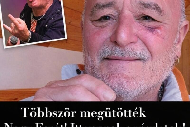 Nagy Ferót véresre verték