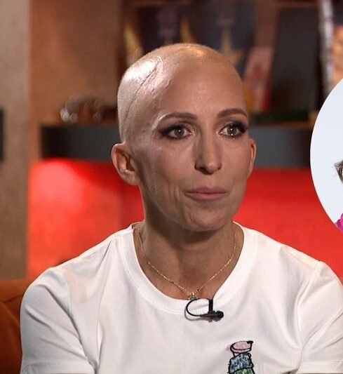 Rubint Réka a Tényekben vette le parókáját, sírva beszélt a betegségéről