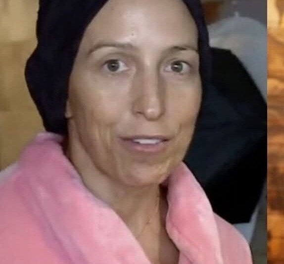 Rubint Réka a Tényekben vette le parókáját, sírva beszélt a betegségéről